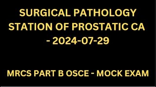 SURGICAL PATHOLOGY STATION OF PROSTATIC CA [upl. by Aneehsat30]