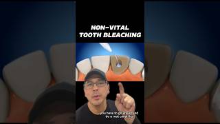 Procedural Steps for NonVital Tooth Bleaching  In Office to Hands On Dental Training shorts [upl. by Leyla]