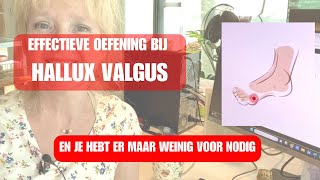 EFFECTIEVE OEFENING HALLUX VALGUS [upl. by Andee]