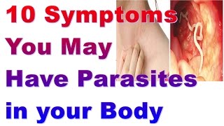 10 Symptoms You May Have Parasites in your Body and how to remove themHealthy Life Recipe [upl. by Anerda]