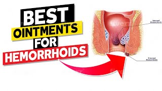 Best Ointments for Hemorrhoids [upl. by Meenen]