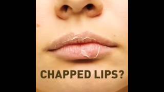 Chapped lips ke liye jugaddry lips craft ideas 👄🔥 lipcare chappedlips MissJugadunk3in [upl. by Ellswerth]