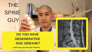 Lumbar Degenerative Disc Disease Part 1 Symptoms and Imaging [upl. by Burnsed]