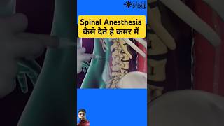 Spinal Anesthesia kaise dete hai anesthisa mbbs knowledge science shorts [upl. by Derf605]