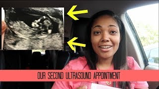 OUR SECOND ULTRASOUND APPOINTMENT [upl. by Eerazed]