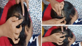 ASMR  Scalp Check and Massage Relaxation Sleep 💤😴💤💤 [upl. by Haisa76]