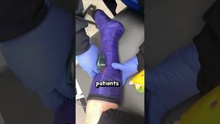 Why a Saw Can Be Safe for Cutting Casts 🛠️✨ [upl. by Deehan]