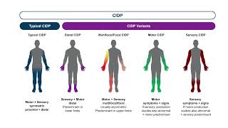 Optimizing Outcomes in CIDP Honing Diagnostic Accuracy Personalizing Treatment Plans [upl. by Inva260]