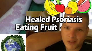 Heal Psoriasis Naturally  Raw • Vegan • Fruititarian • PlantBased Cure [upl. by Andy]