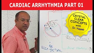 Cardiac Arrhythmia  Part 13 [upl. by Ariaek]