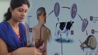 Fasciola Disease Cure Found by Divya Jyoti Singh [upl. by Norga258]