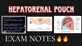 Hepatorenal Pouch under 7 minutes🔥🔥 ABDOMEN ANATOMY [upl. by Yllier34]