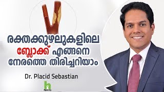 രക്തകുഴലുകളിലെ ബ്ലോക്ക് എങ്ങനെ നേരത്തെ തിരിച്ചറിയാം  Malayalam Health Tips [upl. by Elenaj]