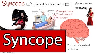 Syncope and Fainting Syncope Types and Treatment Simply explained [upl. by Anaillil862]