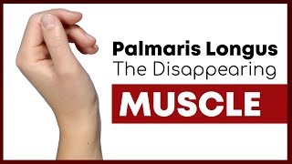 Palmaris Longus The Muscle You Might Not Have  Corporis [upl. by Bebe180]