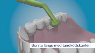 Rengör dina tandimplantat från insidan med TePe Implant Care™ [upl. by Gilbart703]