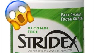 Stridex Acne Pads 😩 Must Watch  👀 [upl. by Anawad]