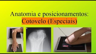 Anatomia e posicionamentos Cotovelo  especiais Método de Jones e Coyle [upl. by Arze]