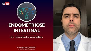 Endometriose Intestinal Dr Fernando Lemos explica [upl. by Nnaeiluj468]