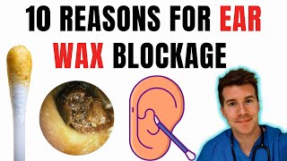 10 risk factors for developing excessive ear wax buildup and blockage [upl. by Ollayos965]