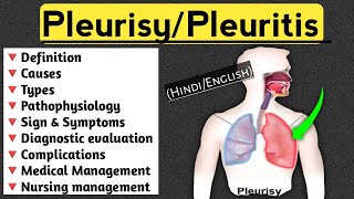 PleurisyPleuritis lecture in Hindi and English medical nursingcriteria pleuritis paramedical [upl. by Jaret]