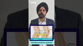 Understanding and Overcoming Knee Pain on Stairs Causes and SolutionsDr Saravpreet Ahluwalias [upl. by Gillan]