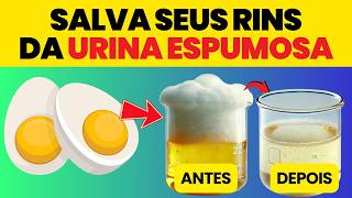 Os 6 Alimentos Estupendos que Protegem os Rins da Proteinúria  Manual do Corpo [upl. by Sidonius649]