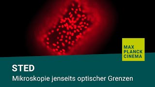 STED  Mikroskopie jenseits optischer Grenzen [upl. by Atikihs]