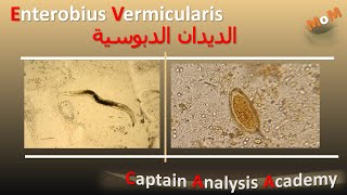 Enterobius Vermicularis الديدان الدبوسيـــه بالتفصيل وازاى بتصيب الاطفال وطرق تشخيصها [upl. by Aisyat]