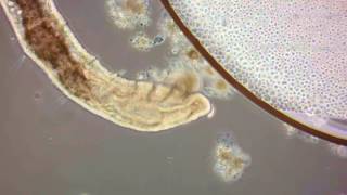 Bristle Worm in Wastewater [upl. by Hourihan]