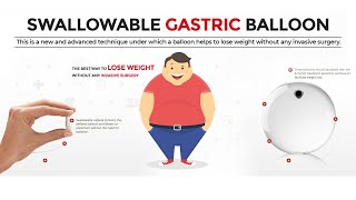 Swallowable Gastric Balloon Elipse Allurion Balloon Pill Side Effects Reviews Cost in India [upl. by Lovel]