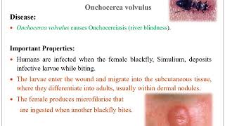 Subject Clinical Parasitology Top Wuchereria Bancrofti amp Onchocerca volvulus 5th Semester MLT [upl. by Sidney150]