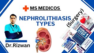 NephrolithiasisSurgeryMS MedicosDr RizwanUrdu Hindi Easy Explanations [upl. by Rozina159]