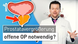 Prostatavergrößerung Prostata zu groß für minimalinvasive OP [upl. by Anak388]