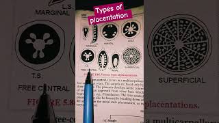 Types of Placentation botany sciencesolvers ytshort [upl. by Publia]