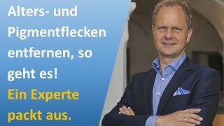 Altersflecken und Pigmentflecken entfernen  wie geht es am besten [upl. by Hsuk]