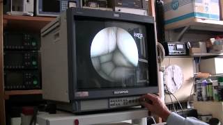 demonstration colonne video Fjinon EPX 201 et EG 200 gastroscope [upl. by Ury]