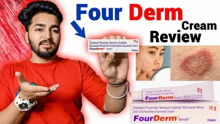 Fourderm Cream Review  Fourderm Cream Kis Kam Ati Hai [upl. by Sillihp]