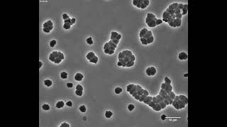 Cholera bacteria can survive antibiotics for a time by turning into globs [upl. by Meneau509]