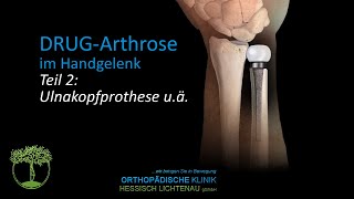 Arthrose des Umwendgelenkes zwischen Elle und Speiche Teil 2 [upl. by Anikes]