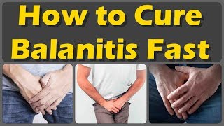 How To Cure Balanitis With Oils Fast And Causes Symptoms And Treatment Of Balanitis [upl. by Hyatt805]