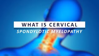 What is Cervical Spondylotic Myelopathy [upl. by Alie326]