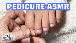 👣ASMR Pedicure Cleaning💆‍♀️Toenail Recovery Pedicure Tutorial👣 [upl. by Eiramlatsyrk]