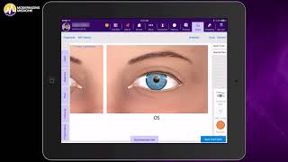 Documenting an Eye Exam in Our Ophthalmology EHR EMA™ [upl. by Venita]