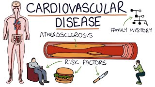 Understanding Cardiovascular Disease Visual Explanation for Students [upl. by Hitoshi]