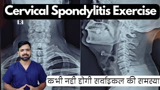 Exercises for cervical spondylitis  Cervical spondylosis exercise in hindi  gardan ki exercise [upl. by Alleuqram936]