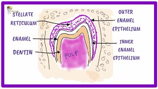 ORAL PATHOLOGY  DENTIGEROUS CYST FORMATION [upl. by Beasley]