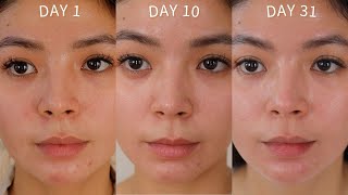 SKINCARE ROUTINE ZO SKIN HEALTH ONE MONTH RESULTS [upl. by Assenal742]