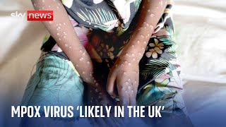 Experts warn deadly mpox virus is quite likely in the UK [upl. by Ietta]