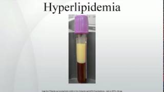 Hyperlipidemia [upl. by Mukund]